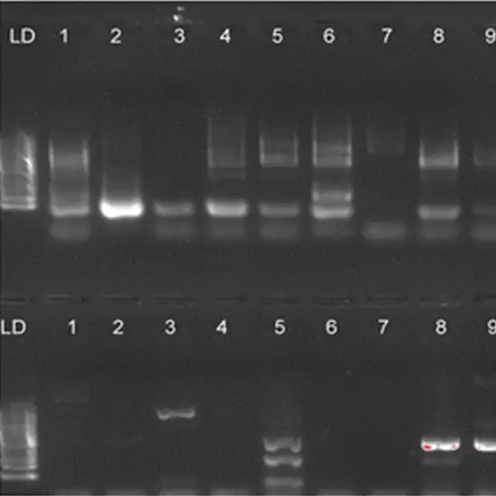 Rubella Detection PCR